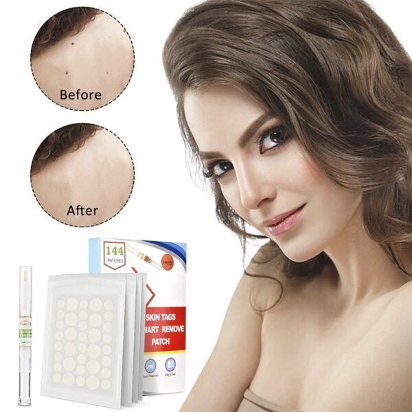 Skin Tag Remover Patches3.jpg