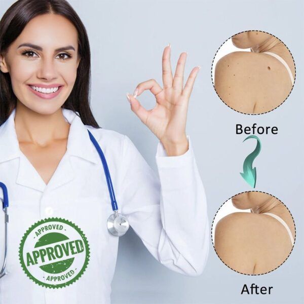 Skin Tag Remover Patches4.jpg